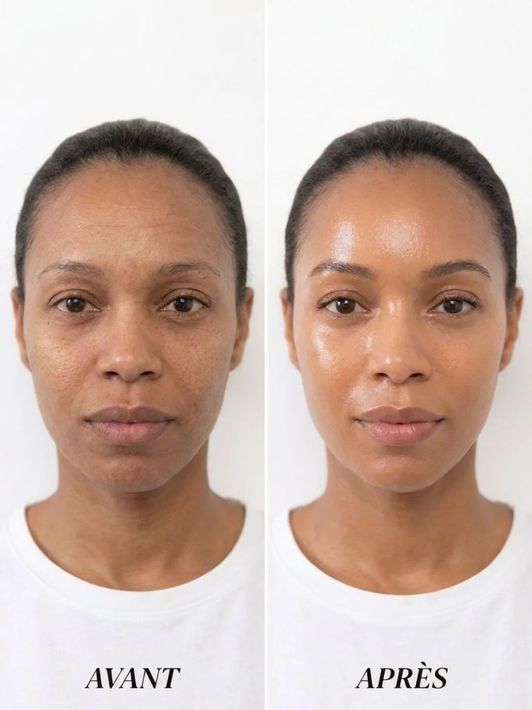 Hydraskin — peau lumineuse et hydratée — vue 4