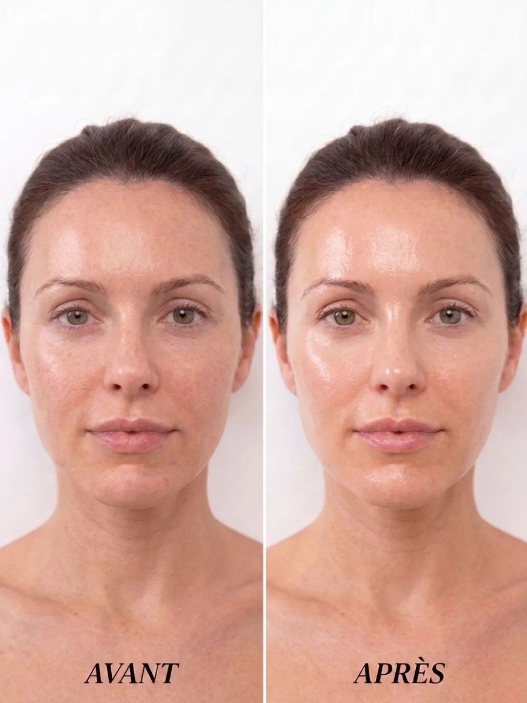 Hydraskin — peau lumineuse et hydratée — vue 5